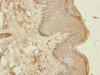 Immunohistochemistry of paraffin-embedded human skin tissue using CSB-PA005214ESR2HU at dilution of 1:100