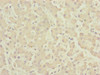 Immunohistochemistry of paraffin-embedded human liver tissue using CSB-PA005214ESR2HU at dilution of 1:100