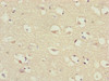 Immunohistochemistry of paraffin-embedded human brain tissue using CSB-PA769805DSR1HU at dilution of 1:100