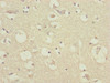 Immunohistochemistry of paraffin-embedded human brain tissue using CSB-PA769805DSR2HU at dilution of 1:100