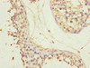 Immunohistochemistry of paraffin-embedded human testis tissue using CSB-PA889176DSR1HU at dilution of 1:100