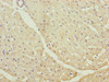 Immunohistochemistry of paraffin-embedded human heart tissue using CSB-PA613263DSR1HU at dilution of 1:100