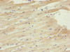 Immunohistochemistry of paraffin-embedded human heart tissue using CSB-PA613263DSR2HU at dilution of 1:100
