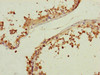 Immunohistochemistry of paraffin-embedded human testis tissue using CSB-PA005266DSR1HU at dilution of 1:100