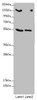 Western blot<br />
 All lanes: CSPP1 antibody at 1.53 µg/ml<br />
 Lane 1: 293T whole cell lysate<br />
 Lane 2: Jurkat whole cell lysate<br />
 Secondary<br />
 Goat polyclonal to rabbit IgG at 1/10000 dilution<br />
 Predicted band size: 146, 142, 102 kDa<br />
 Observed band size: 146, 75, 55 kDa<br />