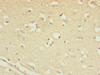 Immunohistochemistry of paraffin-embedded human brain tissue using CSB-PA635936DSR2HU at dilution of 1:100