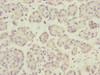 Immunohistochemistry of paraffin-embedded human pancreatic tissue using CSB-PA006566ESR1HU at dilution of 1:100