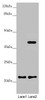 Western blot<br />
 All lanes: DCTN6 antibody at 3.5 µg/ml<br />
 Lane 1: A549 whole cell lysate<br />
 Lane 2: U251 whole cell lysate<br />
 Secondary<br />
 Goat polyclonal to rabbit IgG at 1/10000 dilution<br />
 Predicted band size: 21 kDa<br />
 Observed band size: 21, 40 kDa<br />