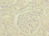 Immunohistochemistry of paraffin-embedded human kidney tissue using CSB-PA006569ESR1HU at dilution of 1:100