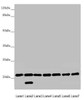 Western blot<br />
 All lanes: DCTN6 antibody at 3.03 µg/ml<br />
 Lane 1: Mouse lung tissue<br />
 Lane 2: Mouse gonadal tissue<br />
 Lane 3: A549 whole cell lysate<br />
 Lane 4: U251 whole cell lysate<br />
 Lane 5: Mouse thymus tissue<br />
 Lane 6: Rat brain tissue<br />
 Lane 7: Mouse stomach tissue<br />
 Secondary<br />
 Goat polyclonal to rabbit IgG at 1/10000 dilution<br />
 Predicted band size: 21 kDa<br />
 Observed band size: 21, 18 kDa<br />
