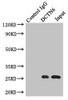 Immunoprecipitating DCTN6 in A549 whole cell lysate<br />
 Lane 1: Rabbit control IgG instead of (1µg) instead of CSB-PA006569ESR2HU in A549 whole cell lysate.
 For western blotting, a HRP-conjugated light chain specific antibody was used as the Secondary antibody (1/50000) <br />
 Lane 2: CSB-PA006569ESR2HU (4µg) + A549 whole cell lysate (500µg) <br />
 Lane 3: A549 whole cell lysate (20µg) <br />