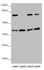 Western blot<br />
 All lanes: DSN1 antibody at 2.19 µg/ml<br />
 Lane 1: Hela whole cell lysate<br />
 Lane 2: Mouse skeletal muscle tissue<br />
 Lane 3: Mouse lung tissue<br />
 Lane 4: Mouse stomach tissue<br />
 Secondary<br />
 Goat polyclonal to rabbit IgG at 1/10000 dilution<br />
 Predicted band size: 41, 33, 39, 28 kDa<br />
 Observed band size: 41, 70 kDa<br />