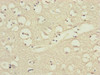 Immunohistochemistry of paraffin-embedded human brain tissue using CSB-PA880969ESR1HU at dilution of 1:100