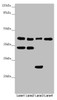 Western blot<br />
 All lanes: DSN1 antibody at 3.09 µg/ml<br />
 Lane 1: Hela whole cell lysate<br />
 Lane 2: MCF-7 whole cell lysate<br />
 Lane 3: Mouse lung tissue<br />
 Lane 4: Mouse gonadal tissue<br />
 Secondary<br />
 Goat polyclonal to rabbit IgG at 1/10000 dilution<br />
 Predicted band size: 41, 33, 39, 28 kDa<br />
 Observed band size: 41, 34, 23 kDa<br />