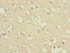 Immunohistochemistry of paraffin-embedded human brain tissue using CSB-PA880969ESR2HU at dilution of 1:100