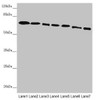 Western blot<br />
 All lanes: DYNC1I1 antibody at 2.52µg/ml<br />
 Lane 1: Mouse brain tissue<br />
 Lane 2: Mouse gonadal tissue<br />
 Lane 3: K562 whole cell lysate<br />
 Lane 4: HL60 whole cell lysate<br />
 Lane 5: Mouse lung tissue<br />
 Lane 6: Mouse skeletal muscle tissue<br />
 Lane 7: Mouse stomach tissue<br />
 Secondary<br />
 Goat polyclonal to rabbit IgG at 1/10000 dilution<br />
 Predicted band size: 73, 71, 69, 68 kDa<br />
 Observed band size: 73 kDa<br />