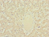 Immunohistochemistry of paraffin-embedded human liver tissue using CSB-PA844722ESR1HU at dilution of 1:100