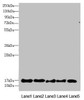 Western blot<br />
 All lanes: FAM96B antibody at 7.23µg/ml<br />
 Lane 1: Mouse gonadal tissue<br />
 Lane 2: MCF-7 whole cell lysate<br />
 Lane 3: Hela whole cell lysate<br />
 Lane 4: K562 whole cell lysate<br />
 Lane 5: A375 whole cell lysate<br />
 Secondary<br />
 Goat polyclonal to rabbit IgG at 1/10000 dilution<br />
 Predicted band size: 18 kDa<br />
 Observed band size: 18 kDa<br />