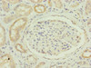 Immunohistochemistry of paraffin-embedded human kidney tissue using CSB-PA897544ESR1HU at dilution of 1:100