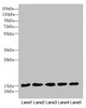 Western blot<br />
 All lanes: FAM96B antibody at 7.09µg/ml<br />
 Lane 1: Mouse gonadal tissue<br />
 Lane 2: MCF-7 whole cell lysate<br />
 Lane 3: Hela whole cell lysate<br />
 Lane 4: K562 whole cell lysate<br />
 Lane 5: A375 whole cell lysate<br />
 Secondary<br />
 Goat polyclonal to rabbit IgG at 1/10000 dilution<br />
 Predicted band size: 18 kDa<br />
 Observed band size: 18 kDa<br />