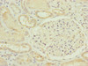 Immunohistochemistry of paraffin-embedded human kidney tissue using CSB-PA897544ESR2HU at dilution of 1:100