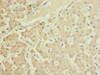 Immunohistochemistry of paraffin-embedded human liver tissue using CSB-PA839313ESR1HU at dilution of 1:100