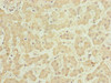 Immunohistochemistry of paraffin-embedded human liver tissue using CSB-PA839313ESR2HU at dilution of 1:100