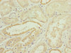 Immunohistochemistry of paraffin-embedded human kidney tissue using CSB-PA839313ESR2HU at dilution of 1:100