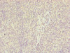 Immunohistochemistry of paraffin-embedded human tonsil tissue using CSB-PA887028ESR1HU at dilution of 1:100