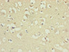 Immunohistochemistry of paraffin-embedded human brain tissue using CSB-PA887028ESR2HU at dilution of 1:100