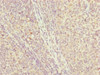 Immunohistochemistry of paraffin-embedded human tonsil tissue using CSB-PA887028ESR2HU at dilution of 1:100