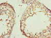 Immunohistochemistry of paraffin-embedded human testis tissue using CSB-PA882183ESR1HU at dilution of 1:100