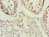 Immunohistochemistry of paraffin-embedded human testis tissue using CSB-PA882183ESR2HU at dilution of 1:100