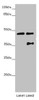 Western blot<br />
 All lanes: CEP44 antibody at 3.09 µg/ml<br />
 Lane 1: Jurkat whole cell lysate<br />
 Lane 2: MCF-7 whole cell lysate<br />
 Secondary<br />
 Goat polyclonal to rabbit IgG at 1/10000 dilution<br />
 Predicted band size: 44 kDa<br />
 Observed band size: 44, 36 kDa<br />