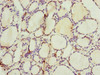 Immunohistochemistry of paraffin-embedded human thyroid tissue using CSB-PA880157ESR1HU at dilution of 1:100