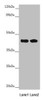 Western blot<br />
 All lanes: CEP44 antibody at 6.92µg/ml<br />
 Lane 1: Jurkat whole cell lysate<br />
 Lane 2: MCF-7 whole cell lysate<br />
 Secondary<br />
 Goat polyclonal to rabbit IgG at 1/10000 dilution<br />
 Predicted band size: 44 kDa<br />
 Observed band size: 44 kDa<br />