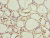 Immunohistochemistry of paraffin-embedded human thyroid tissue using CSB-PA880157ESR2HU at dilution of 1:100
