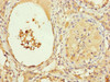 Immunohistochemistry of paraffin-embedded human testis tissue using CSB-PA855506ESR1HU at dilution of 1:100