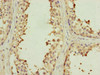 Immunohistochemistry of paraffin-embedded human testis tissue using CSB-PA855506ESR2HU at dilution of 1:100