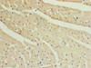 Immunohistochemistry of paraffin-embedded human heart tissue using CSB-PA855506ESR2HU at dilution of 1:100