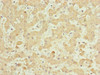 Immunohistochemistry of paraffin-embedded human liver tissue using CSB-PA871623ESR1HU at dilution of 1:100