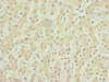 Immunohistochemistry of paraffin-embedded human liver tissue using CSB-PA871623ESR2HU at dilution of 1:100