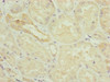 Immunohistochemistry of paraffin-embedded human kidney tissue using CSB-PA863116ESR1HU at dilution of 1:100