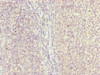 Immunohistochemistry of paraffin-embedded human tonsil tissue using CSB-PA863116ESR1HU at dilution of 1:100