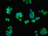 Immunofluorescent analysis of PC-3 cells using CSB-PA863116ESR1HU at dilution of 1:100 and Alexa Fluor 488-congugated AffiniPure Goat Anti-Rabbit IgG (H+L)