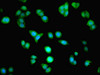 Immunofluorescent analysis of PC-3 cells using CSB-PA863116ESR2HU at dilution of 1:100 and Alexa Fluor 488-congugated AffiniPure Goat Anti-Rabbit IgG (H+L)