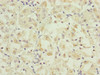 Immunohistochemistry of paraffin-embedded human gastric cancer using CSB-PA861174DSR1HU at dilution of 1:100