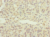 Immunohistochemistry of paraffin-embedded human adrenal gland tissue using CSB-PA896533ESR1HU at dilution of 1:100