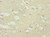 Immunohistochemistry of paraffin-embedded human brain tissue using CSB-PA836171ESR1HU at dilution of 1:100