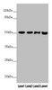 Western blot<br />
 All lanes: PPP2R3C antibody at 3.76µg/ml<br />
 Lane 1: Mouse stomach tissue<br />
 Lane 2: A431 whole cell lysate<br />
 Lane 3: Jurkat whole cell lysate<br />
 Lane 4: A549 whole cell lysate<br />
 Secondary<br />
 Goat polyclonal to rabbit IgG at 1/10000 dilution<br />
 Predicted band size: 54, 40 kDa<br />
 Observed band size: 54 kDa<br />